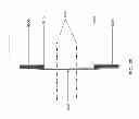 Fig. 72 - Eye aperture enhancing prosthesis and method