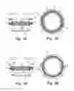 Fig. 02 - Haptic combinations for accommodating intraocular lenses