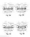 Fig. 04 - Haptic combinations for accommodating intraocular lenses