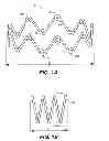 Fig. 02 - Self-expanding devices and methods therefor