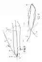 Fig. 04 - Adjustable suture-button constructs for ligament reconstruction