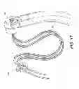 Fig. 07 - Adjustable suture-button constructs for ligament reconstruction