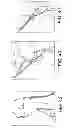 Fig. 13 - Adjustable suture-button constructs for ligament reconstruction