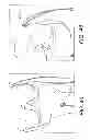 Fig. 14 - Adjustable suture-button constructs for ligament reconstruction