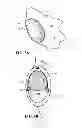 Fig. 07 - Shoulder implant