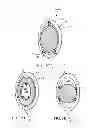Fig. 08 - Shoulder implant