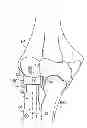 Fig. 01 - Radial head prosthesis with floating articular member