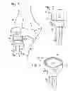 Fig. 02 - Radial head prosthesis with floating articular member