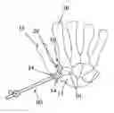 Fig. 01 - JOINT RECONSTRUCTION SYSTEM AND METHOD