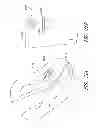 Fig. 22 - Method and apparatus for hip replacement