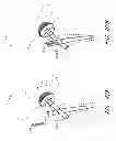 Fig. 35 - Method and apparatus for hip replacement