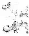 Fig. 41 - Method and apparatus for hip replacement