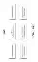 Fig. 43 - Method and apparatus for hip replacement