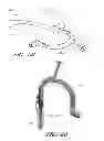 Fig. 49 - Method and apparatus for hip replacement