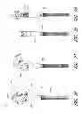 Fig. 63 - Method and apparatus for hip replacement