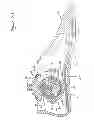 Fig. 06 - Artificial ankle, artificial foot and artificial leg