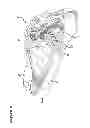 Fig. 07 - Artificial ankle, artificial foot and artificial leg