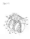 Fig. 08 - Artificial ankle, artificial foot and artificial leg