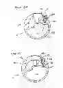 Fig. 16 - Artificial ankle, artificial foot and artificial leg