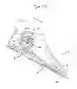 Fig. 20 - Artificial ankle, artificial foot and artificial leg