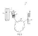 Fig. 04 - Acoustic diagnosis and correction system