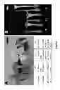 Fig. 02 - Intercellular Transfer of Organelles in Plants for Horizontal Transfer of DNA Expressing Proteins of Interest