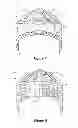 Fig. 04 - Protective helmet cap