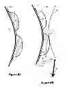 Fig. 07 - Protective helmet cap