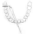Fig. 01 - FLEXIBLE INTERDENTAL BRUSH APPLICATOR AND INTERDENTAL GUM STIMULATOR