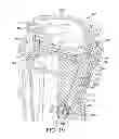 Fig. 22 - Cleaning appliance