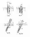 Fig. 09 - Anchoring in a construction model