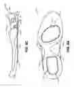 Fig. 16 - Sole structures and articles of footwear having plate moderated fluid-filled bladders and/or foam type impact force attenuation members