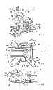Fig. 02 - System for positioning on a patient an observation and/or intervention device