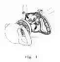 Fig. 02 - Rocker button switch device of dog leash