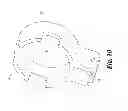 Fig. 10 - Adjustable gas system for firearms