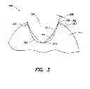 Fig. 04 - Open chamber ammunition