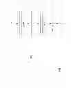 Fig. 04 - Assembly and method for the precision drilling of seed grains