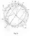 Fig. 06 - Electric phasing of a concentric camshaft