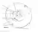Fig. 07 - Rotary machine