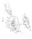 Fig. 04 - Laryngeal mask