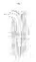 Fig. 08 - Laryngeal mask