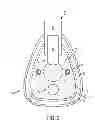 Fig. 03 - Face Mask for Administration of Gaseous Anesthesia