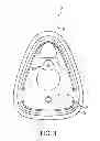 Fig. 04 - Face Mask for Administration of Gaseous Anesthesia