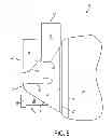 Fig. 06 - Face Mask for Administration of Gaseous Anesthesia