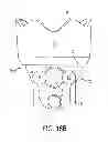 Fig. 22 - Face Mask for Administration of Gaseous Anesthesia