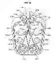 Fig. 04 - Manifold for use in Medicament Dispenser