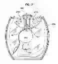 Fig. 17 - Manifold for use in Medicament Dispenser