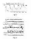 Fig. 02 - Method and apparatus for assessing sleep quality