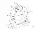 Fig. 01 - Positive airway pressure system with head position control