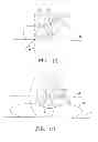 Fig. 09 - Positive airway pressure system with head position control